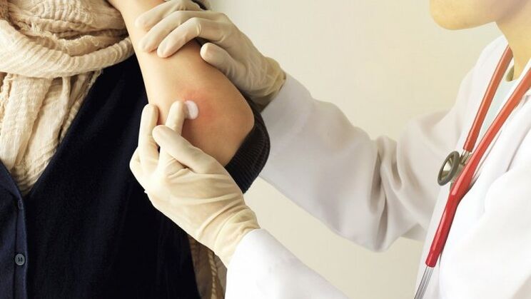 Doctor applying psoriasis on elbow