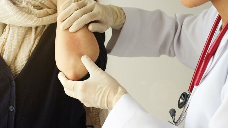 doctor examines elbow psoriasis